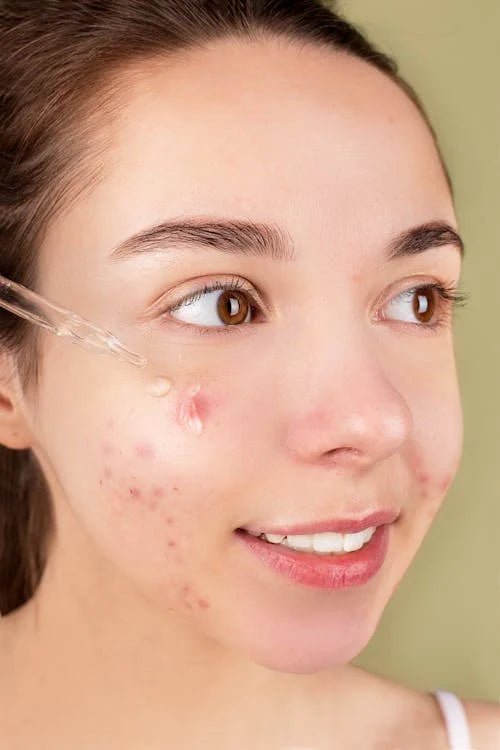 Best spot correcting serum - RorikoConnect