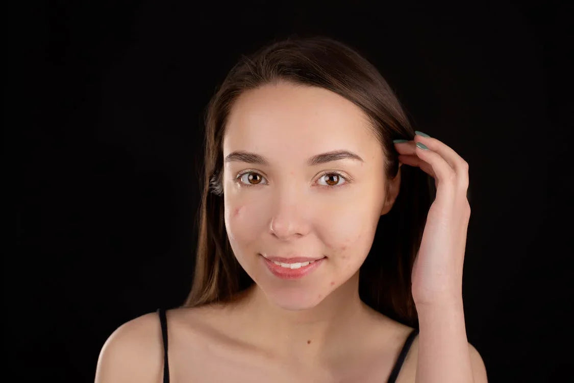 Spot correcting serum for hyperpigmentation