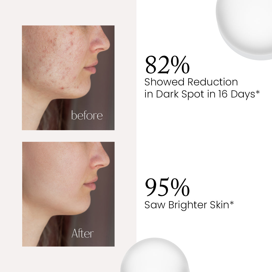 RORIKO Spot Correcting Serum